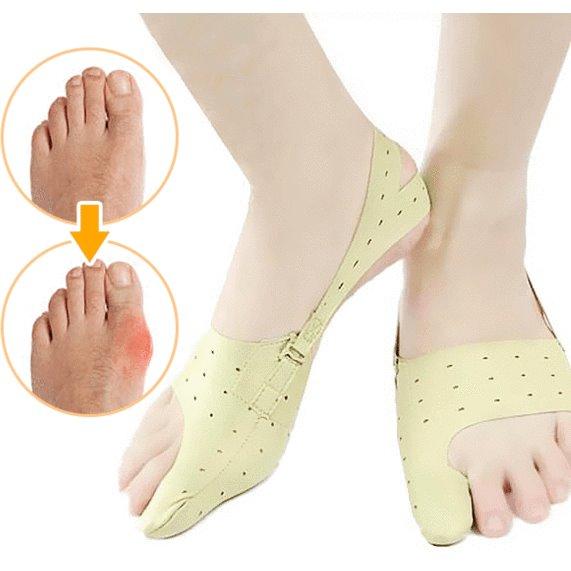 bunion corrector